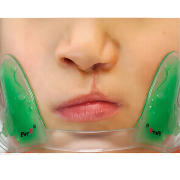[PED-LIPCLEFT-WHLQTY25-INF] Hathor